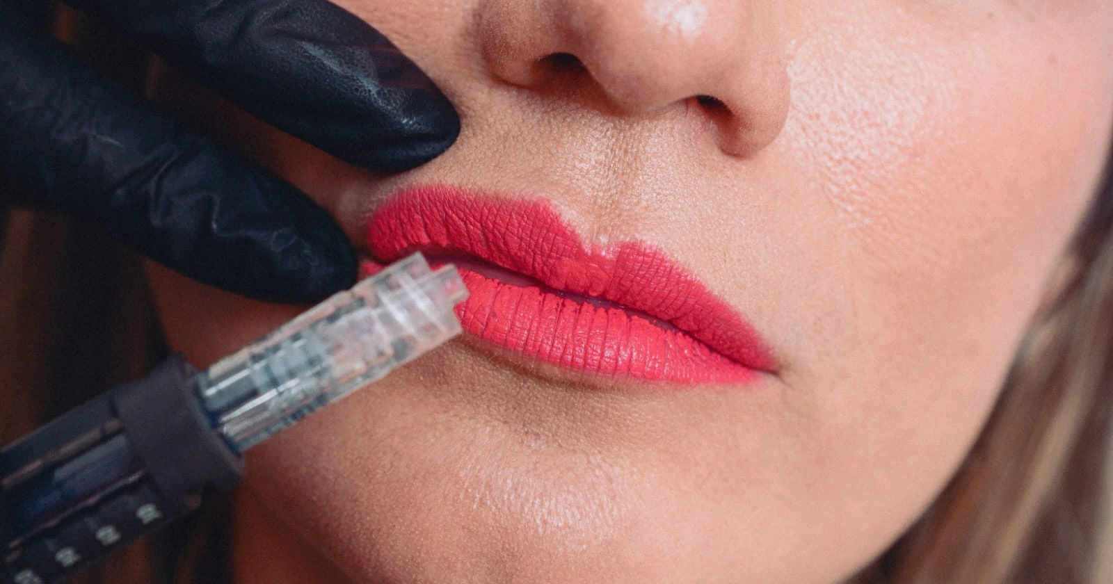 Primer plano de labios recibiendo tratamiento de Arquitectura Labial.