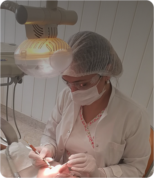 Modelo de yeso de una dentadura con dientes tallados para tratamientos de estética dental.